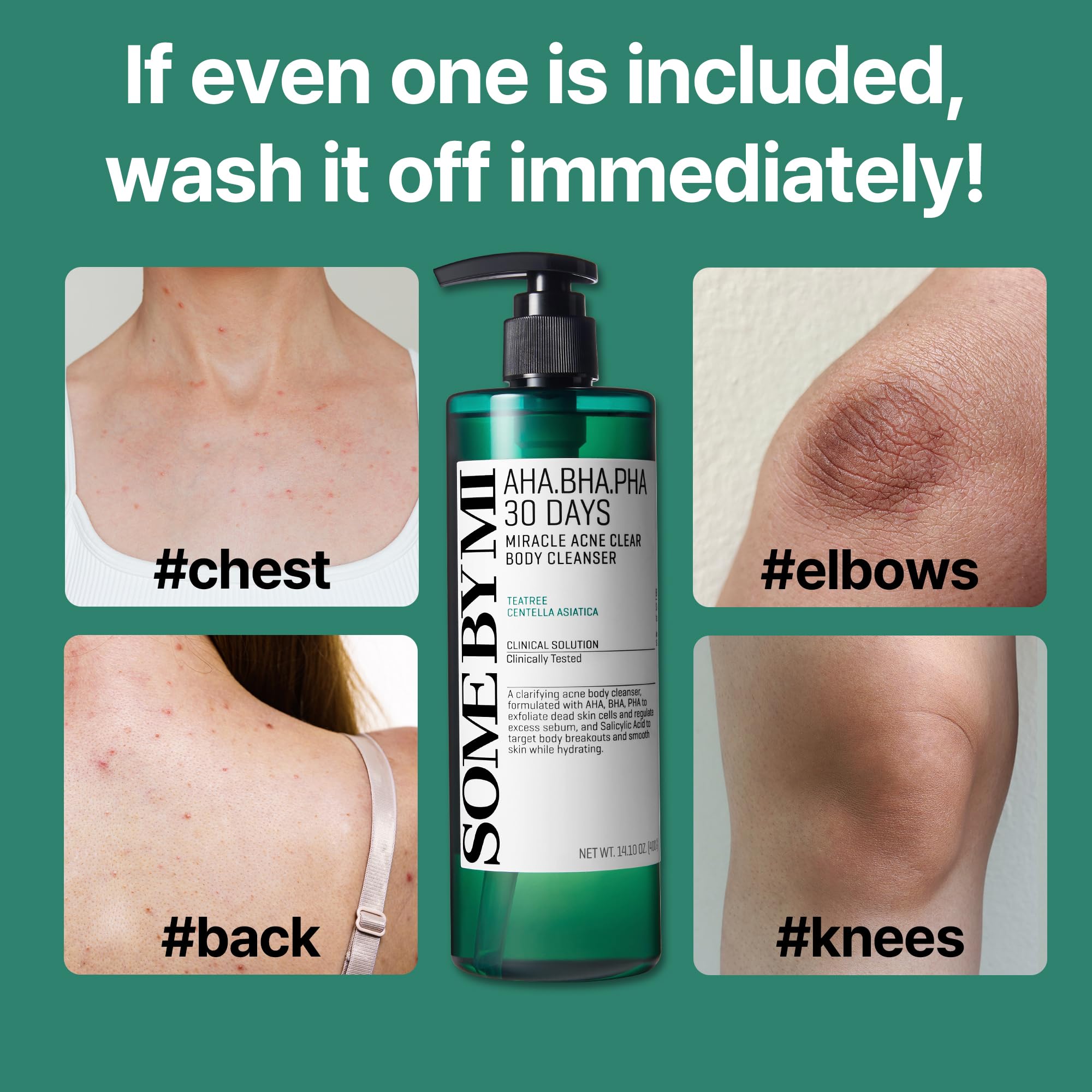 SOME BY MI AHA BHA PHA 30 Days Miracle Acne Clear Body Cleanser & Beta-Panthenol Repair Body Cream - Image 6