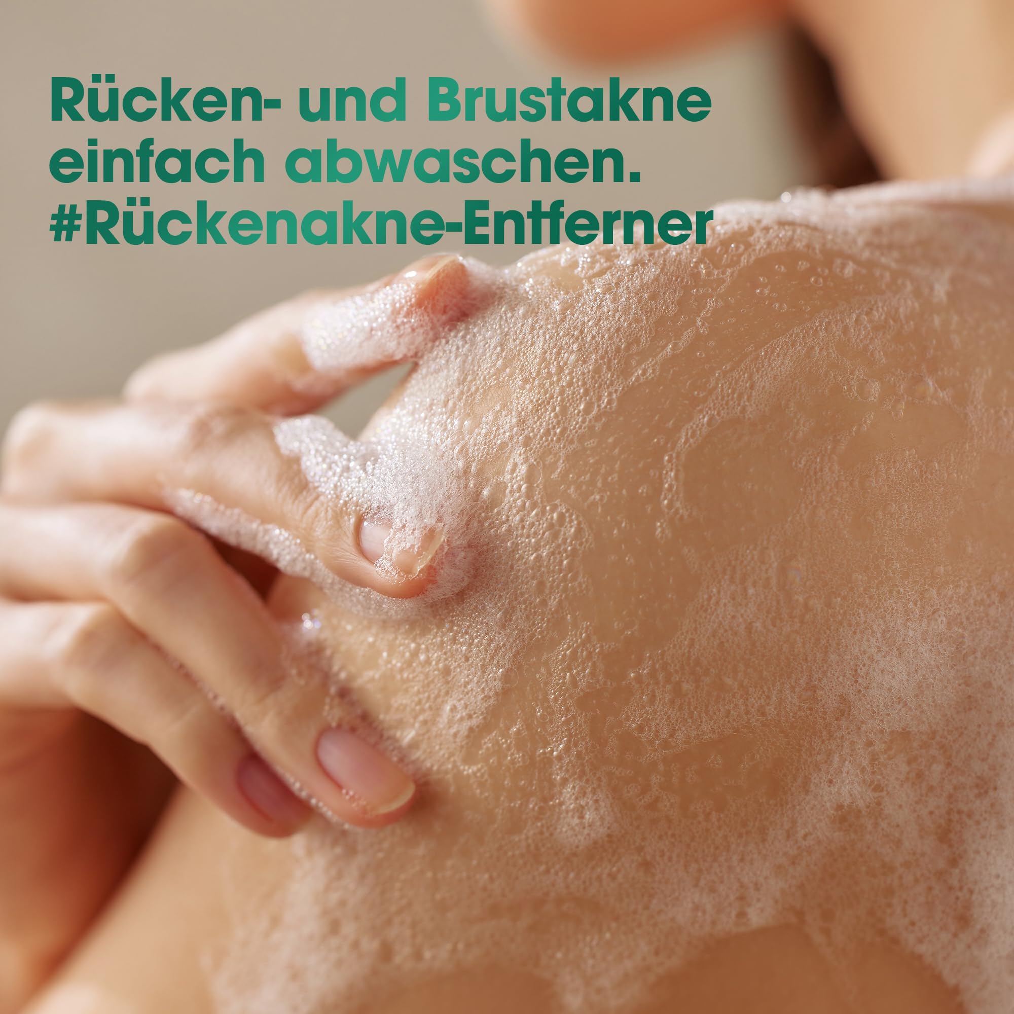 SOME BY MI AHA BHA PHA 30 Days Miracle Acne Clear Body Cleanser & Miracle Acne Clear Foam - Image 5