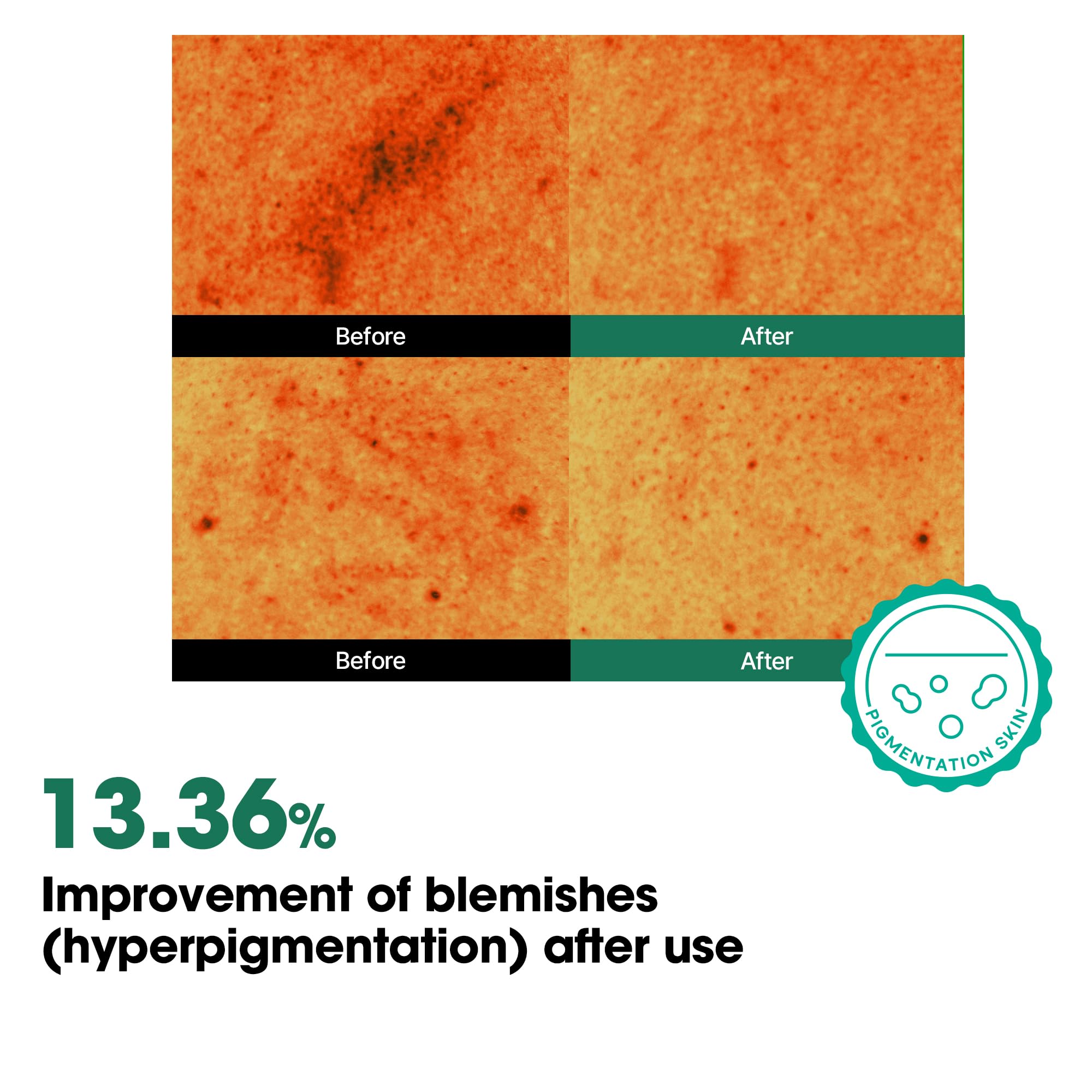 SOME BY MI AHA BHA PHA 30 Days Miracle Body Toner Mist – 4.73oz, 140ml – Body Acne Spray for Back & Chest, Exfoliating Body Mist with Salicylic Acid, Tea Tree, Niacinamide – Korean Skincare - Image 6