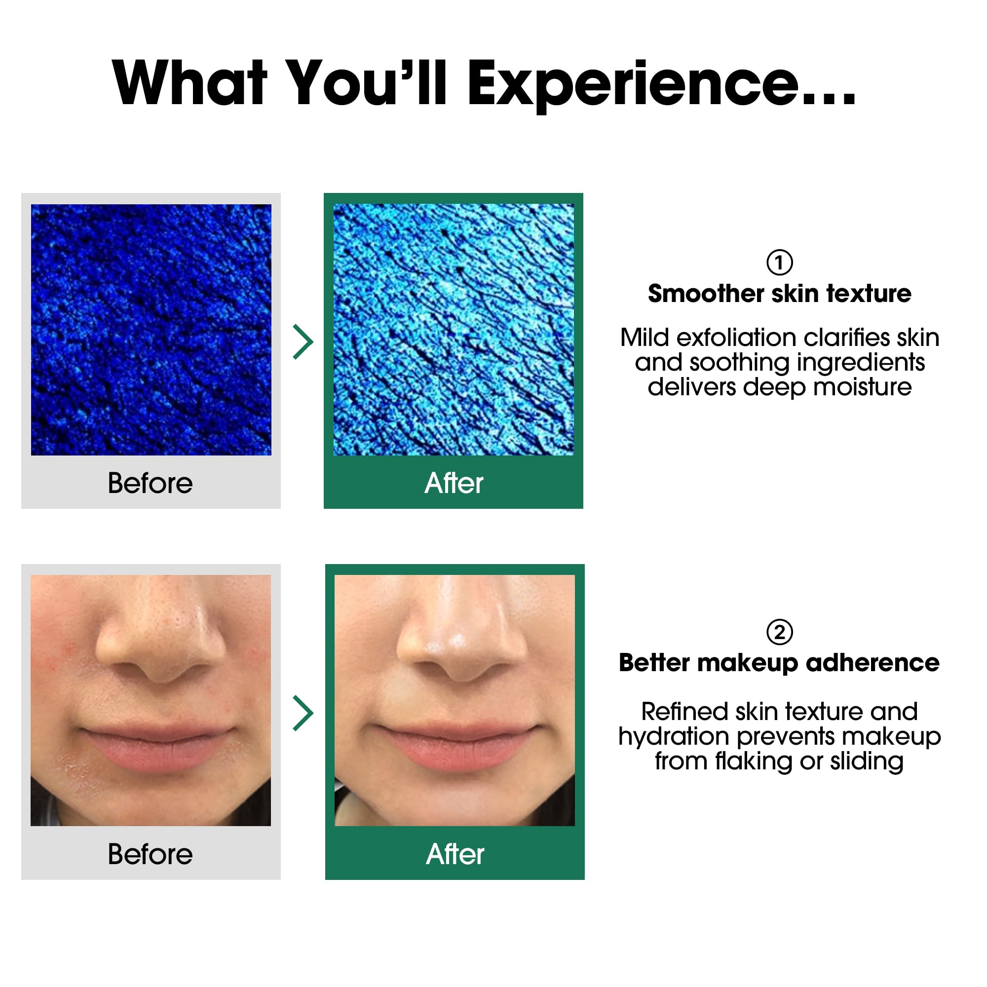 SOME BY MI AHA BHA PHA 30 Days Miracle Toner – 5.07oz, 150ml – Korean Salicylic Acid Exfoliating Face Toner for All Skin Types – Daily Pore Care & Oil Control with 2% Niacinamide – Korean Skin Care - Image 5