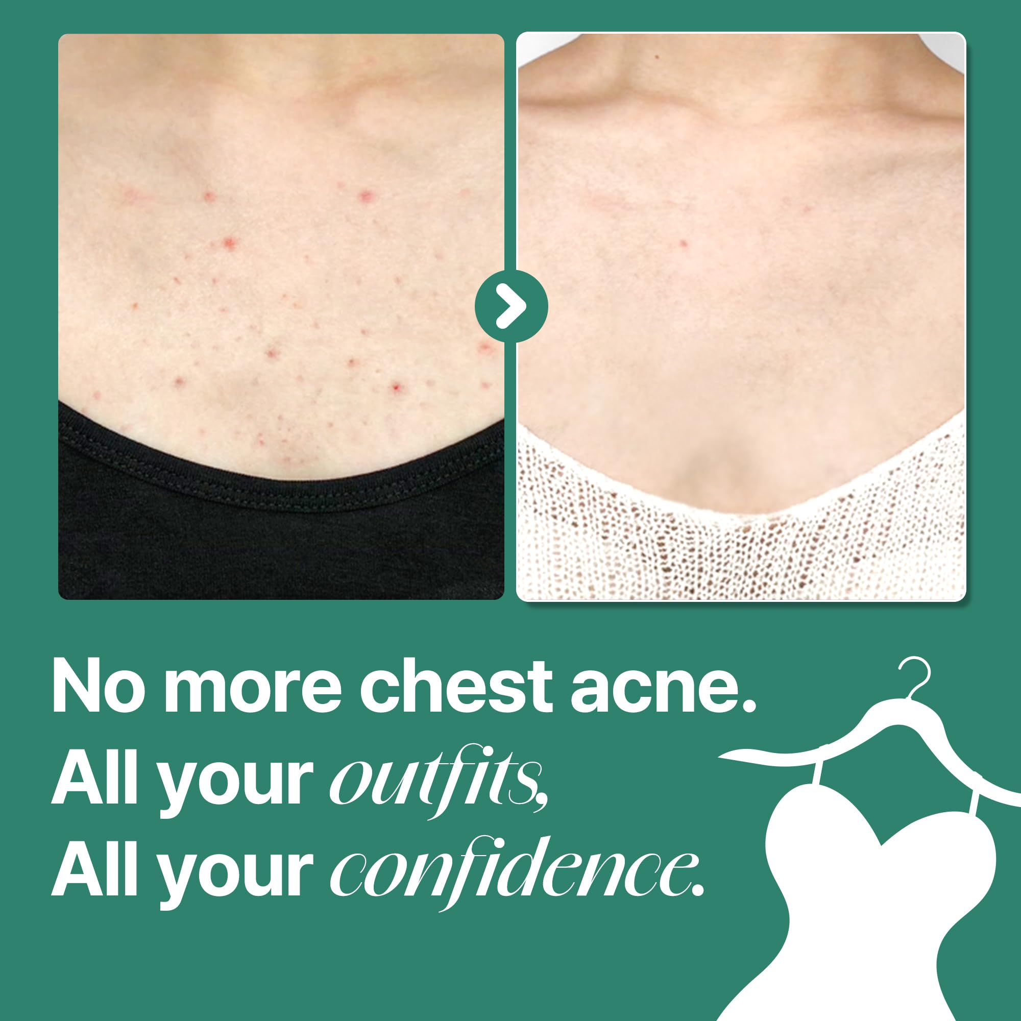 SOME BY MI AHA BHA PHA 30 Days Miracle Acne Clear Body Cleanser & Beta-Panthenol Repair Body Cream - Image 8