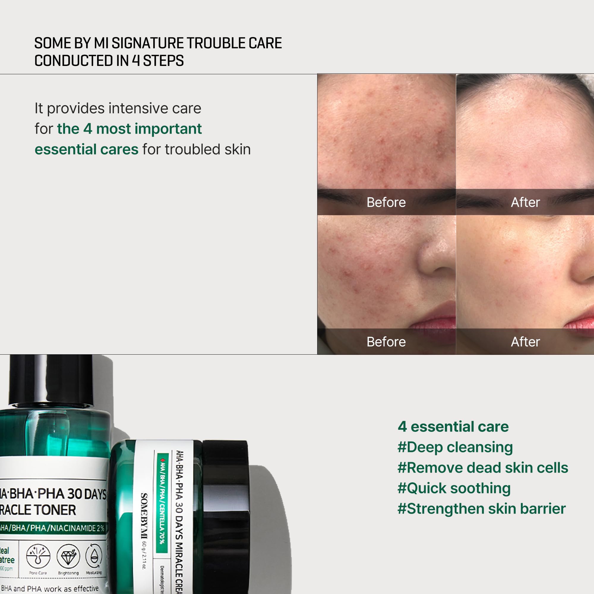 SOME BY MI AHA BHA PHA 30Days Starter Kit - Toner 1.01Oz, Serum 0.33Oz, Cream 0.7Oz, Cleansing Bar 1.05Oz - Mild Exfoliating Daily Skin Care Set - Skin Wastes, Sebum, Oiliness Care - Korean Skin Care - Image 5