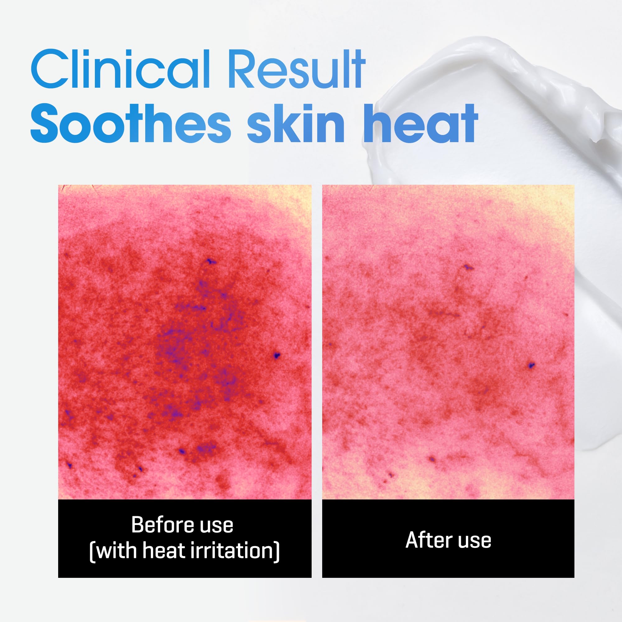 SOME BY MI AHA BHA PHA 30 Days Miracle Acne Clear Body Cleanser & Beta-Panthenol Repair Body Cream - Image 5