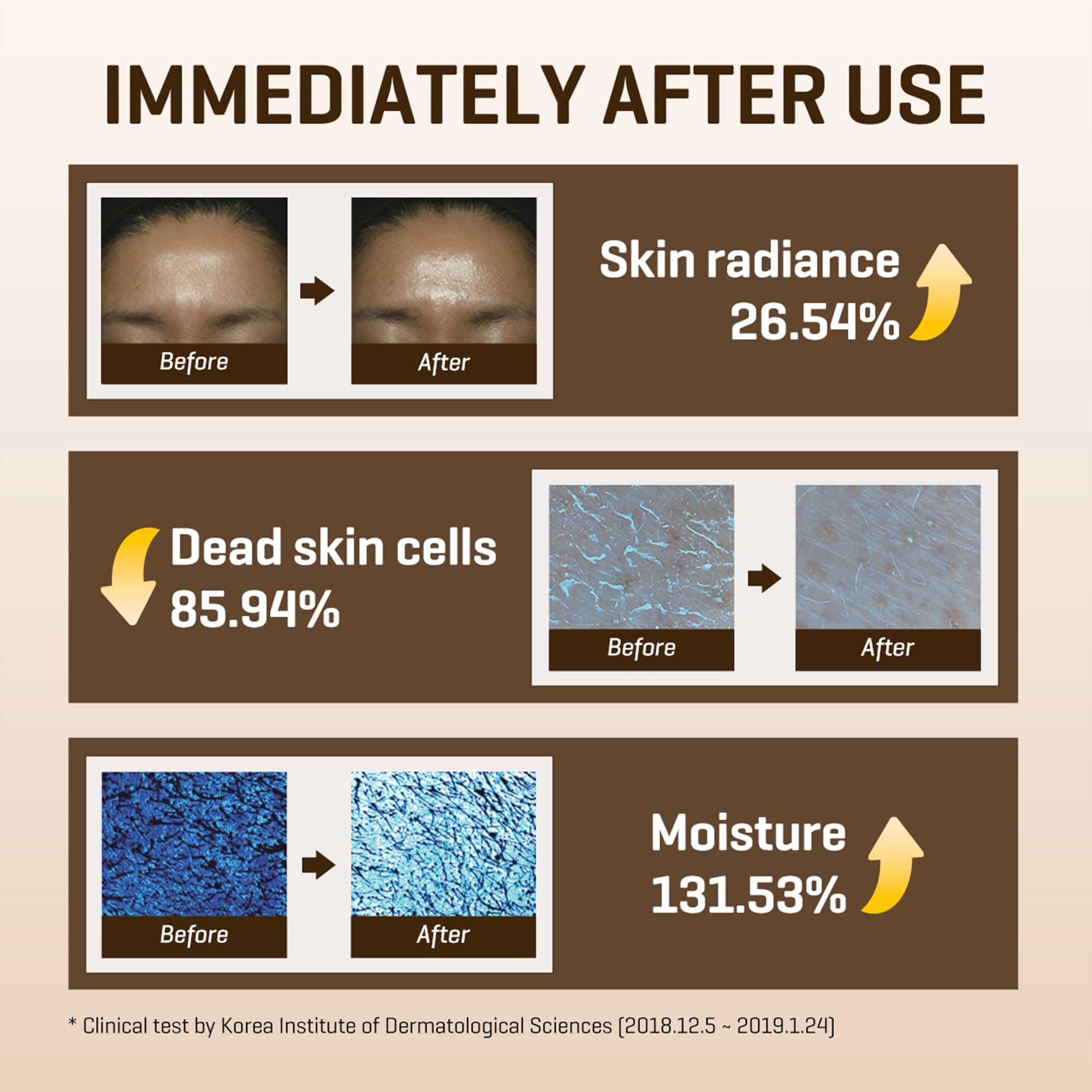 SOME BY MI Galactomyces Pure Vitamin C Glow Toner - 6.76Oz, 200ml - Korean Daily Vitamin C Face Toner for Skin Brightening - Glass Skin Routine with Skin Texture, Elasticity Care - Korean Skin Care - Image 6