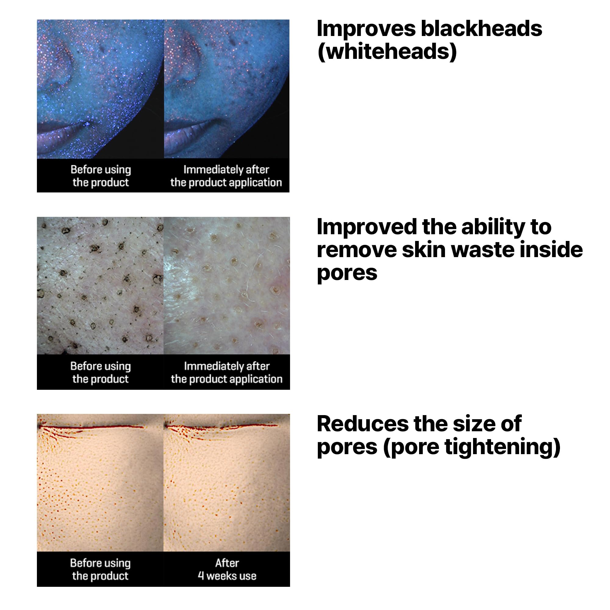 SOME BY MI Lacto Soy Sebum & Blackhead Cleansing Oil – 6.76oz, 200ml – Korean Vegan Makeup-Removing Oil Cleanser with Soybean Extract & Serine – Deep Cleansing for Blackheads & Pore – Korean Skin Care - Image 5